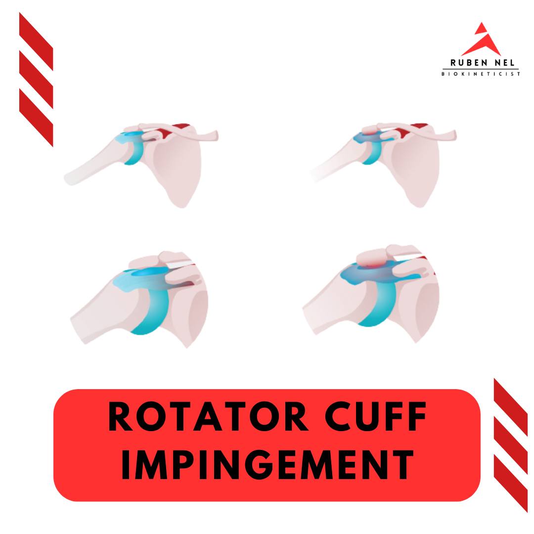 Rnbiokineticist - 🧐 Demystifying Rotator Cuff Impingement Rotator cuff ...