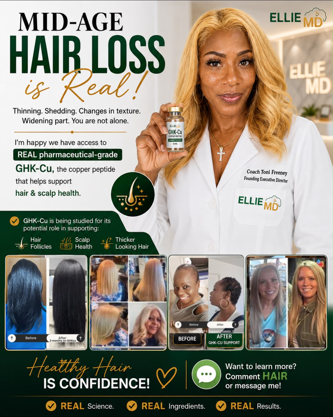 ghk-cu copper peptide hair loss studies Have you heard about GHK-Cu? 💙 This powerful has been gaining attention for its incredible potential to support growth, skin health, and overall rejuvenation. Research suggests may help Red Blood Cell Production Size:30 ml bpc 157 cognitive benefits