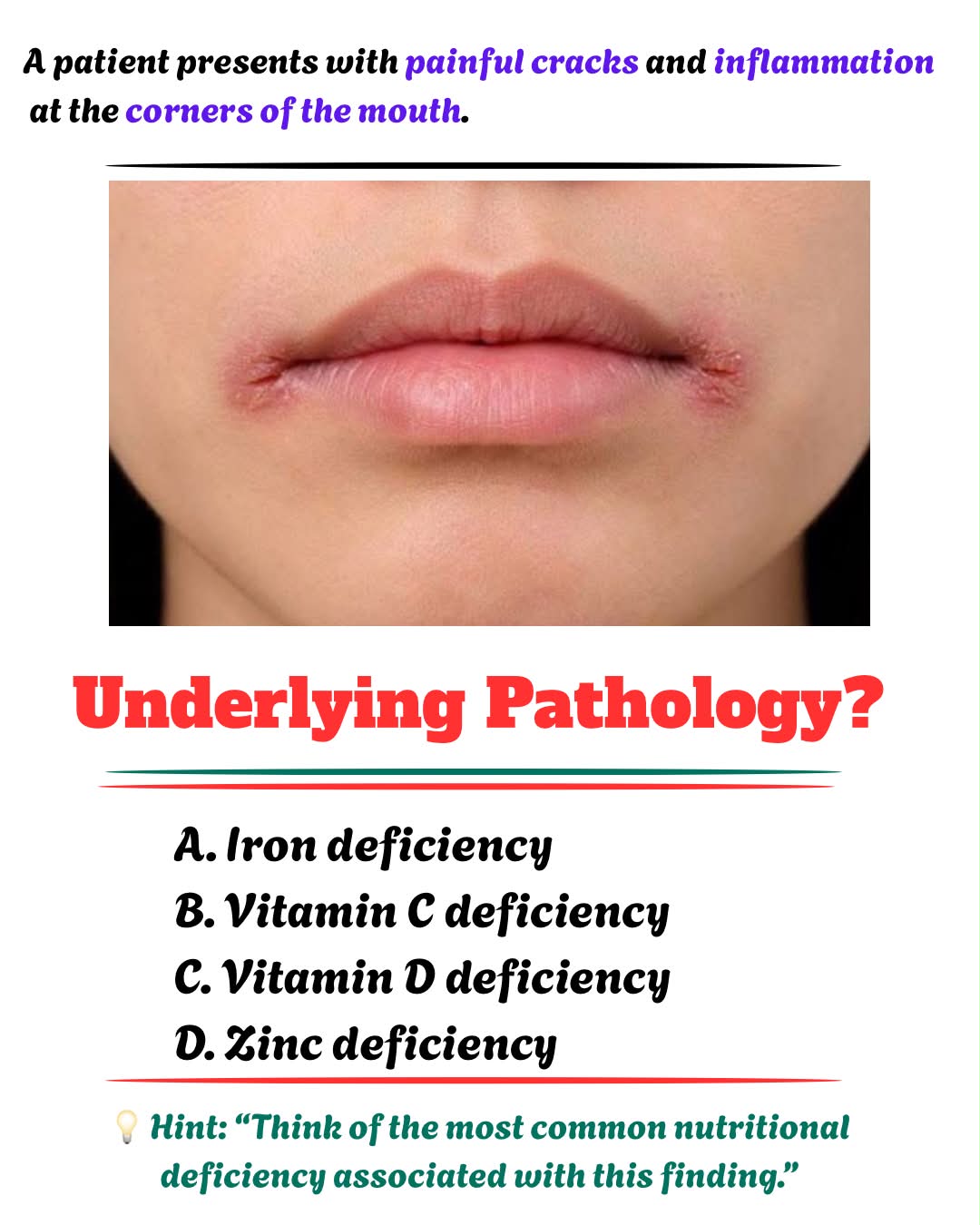 What vitamin deficiency causes cracked lips and painful fissures at the mouth corners?
