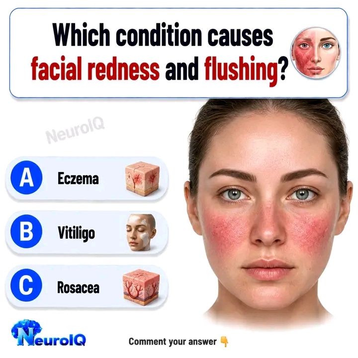 Causes and diagnosis of facial flushing