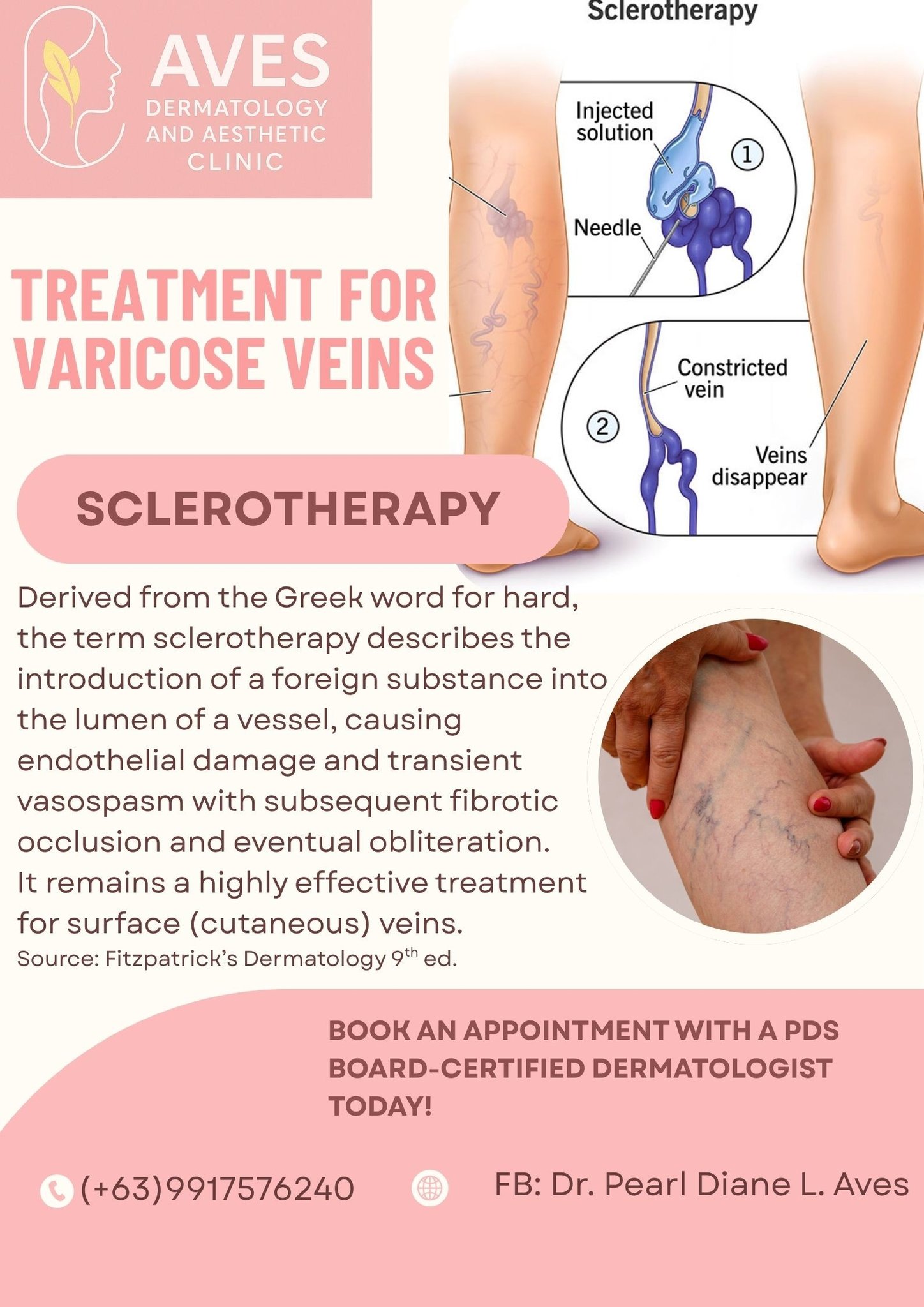 glutathione varicose veins Get rid of fast with “Scelerotherapy Treatment”.💉✨ Invest in your skin here at Zel'e Wellness Center Book now!!! And Get the 10% Discount for Doctor's Procedure (only), Every Tuesday. 📍 TheaWell GHK-Cu Copper Tripeptide-1,