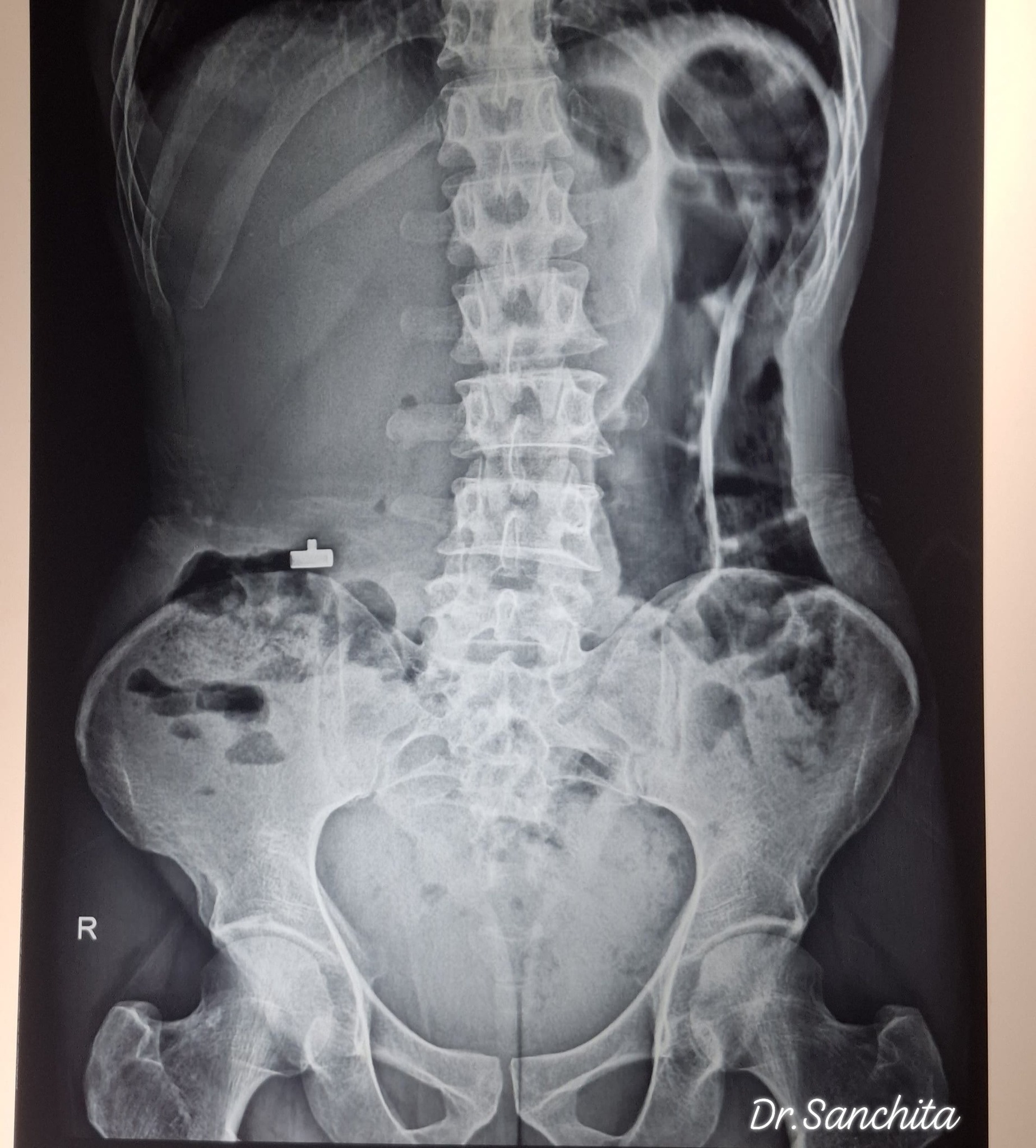 Diagnosis #radiology #medical #radiologist #abdominal #anatomy