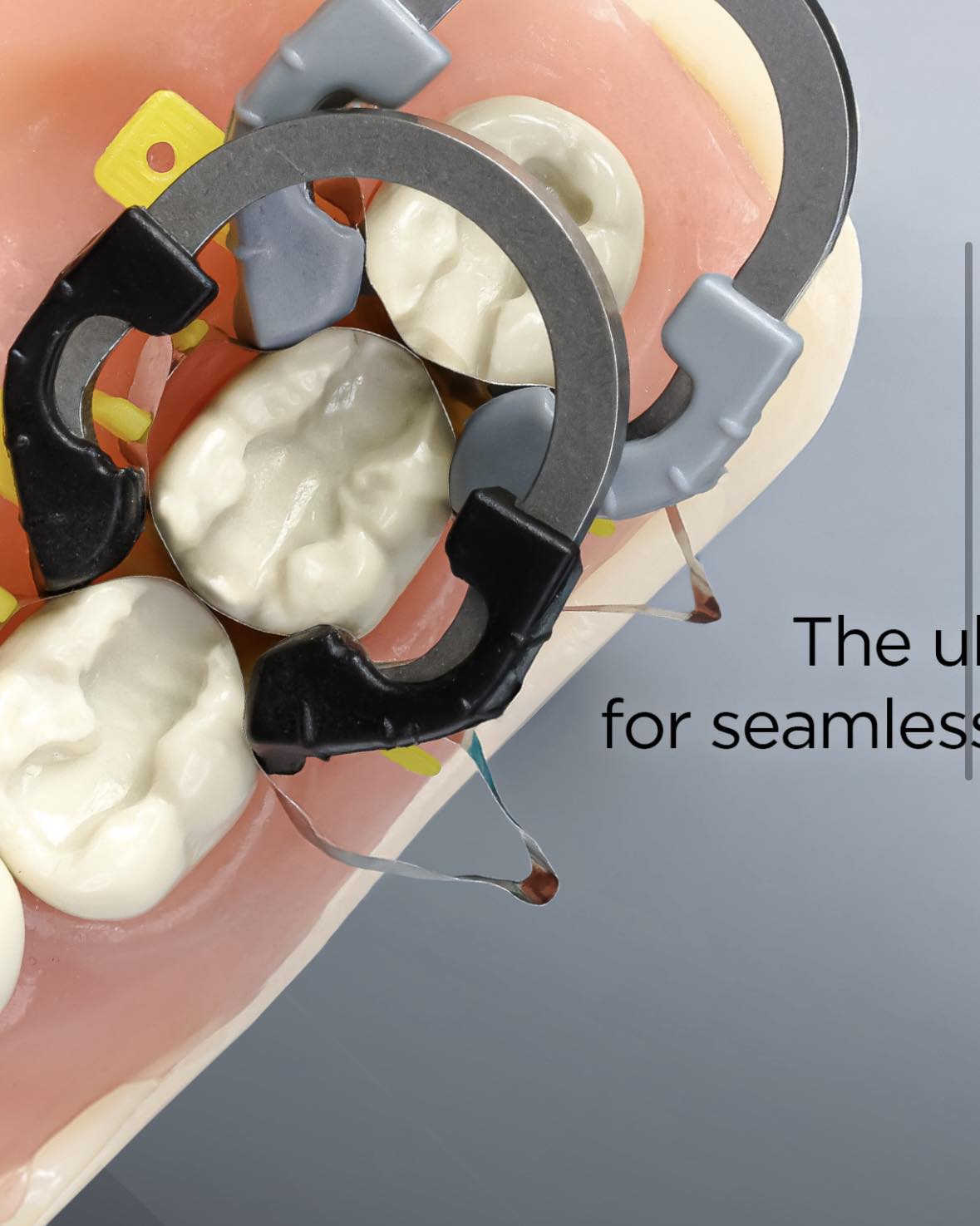 Dental BiBand Matrix | Tampa FL