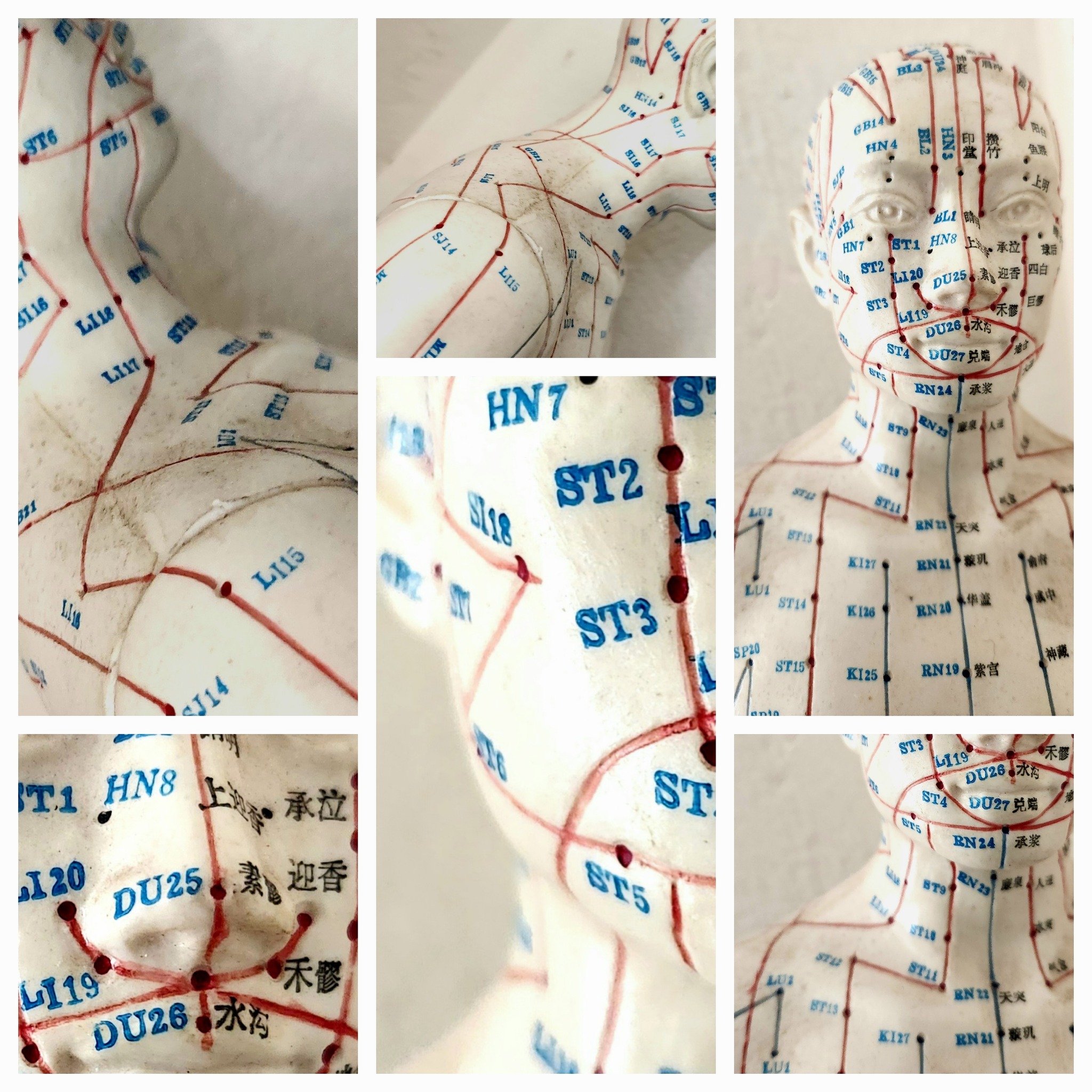 20足 Acupuncture study uses standard and unique acupoints