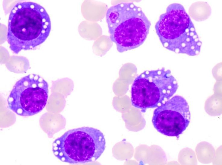 Hematology | Facebook