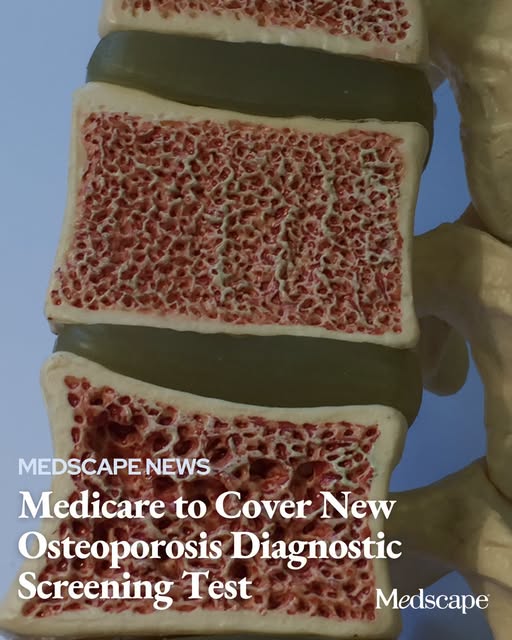 Medicare will soon nationally reimburse a new method for osteoporosis screening that offers a more complete assessment of bone quality and fracture risk than current methods that rely solely on bone mineral