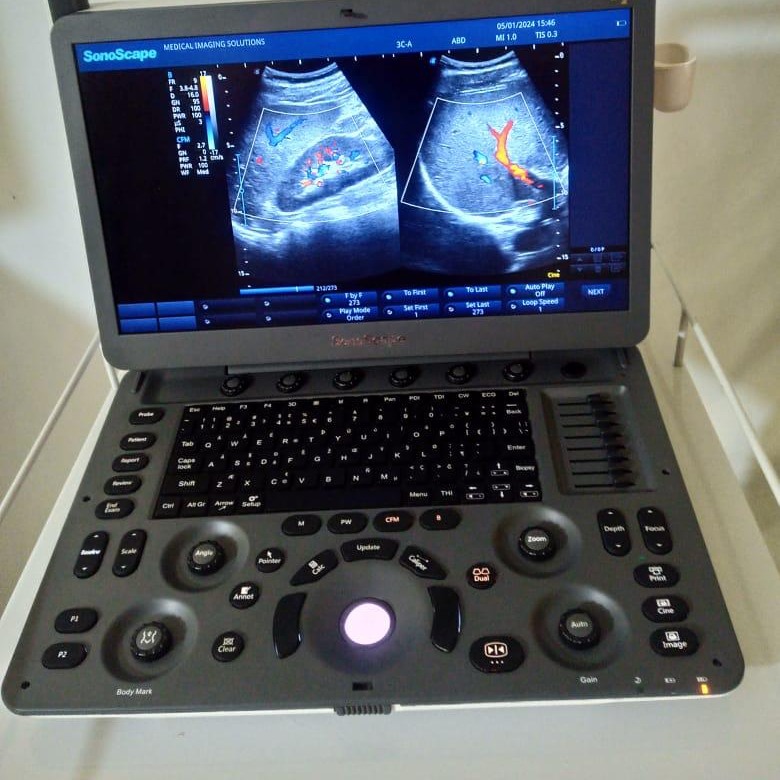 Sonography Canada exam preparation