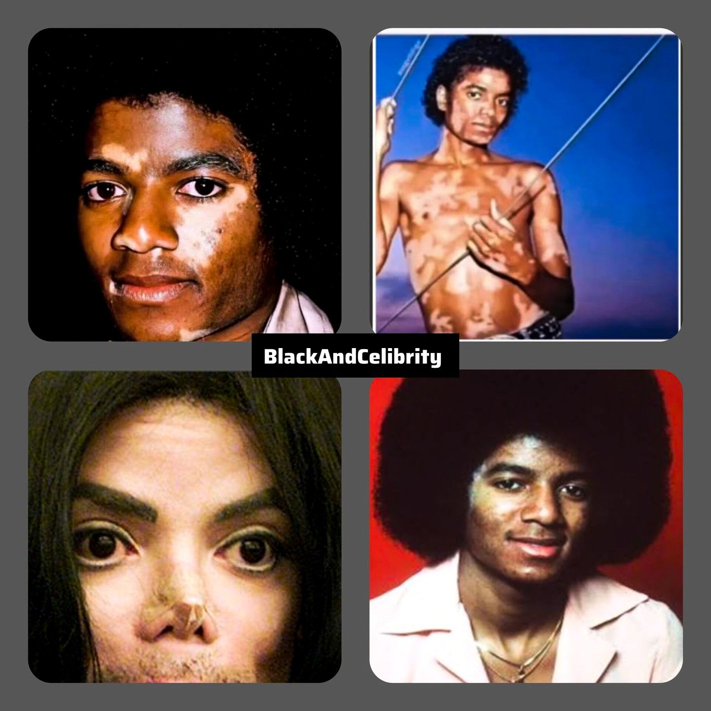 michael jackson glutathione Jackson's struggle with vitiligo Type:Liposome Glutathione Direct Ultra X is bpc 157 Peptide capsules-softgels