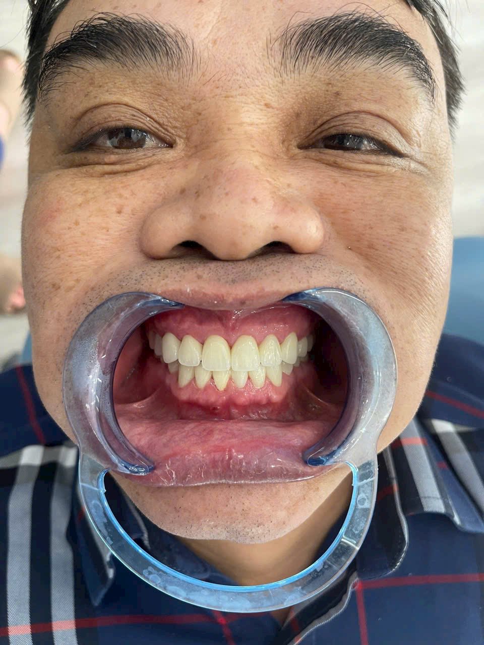 Ảnh 2 của Nha Khoa Quốc Tế Việt Pháp