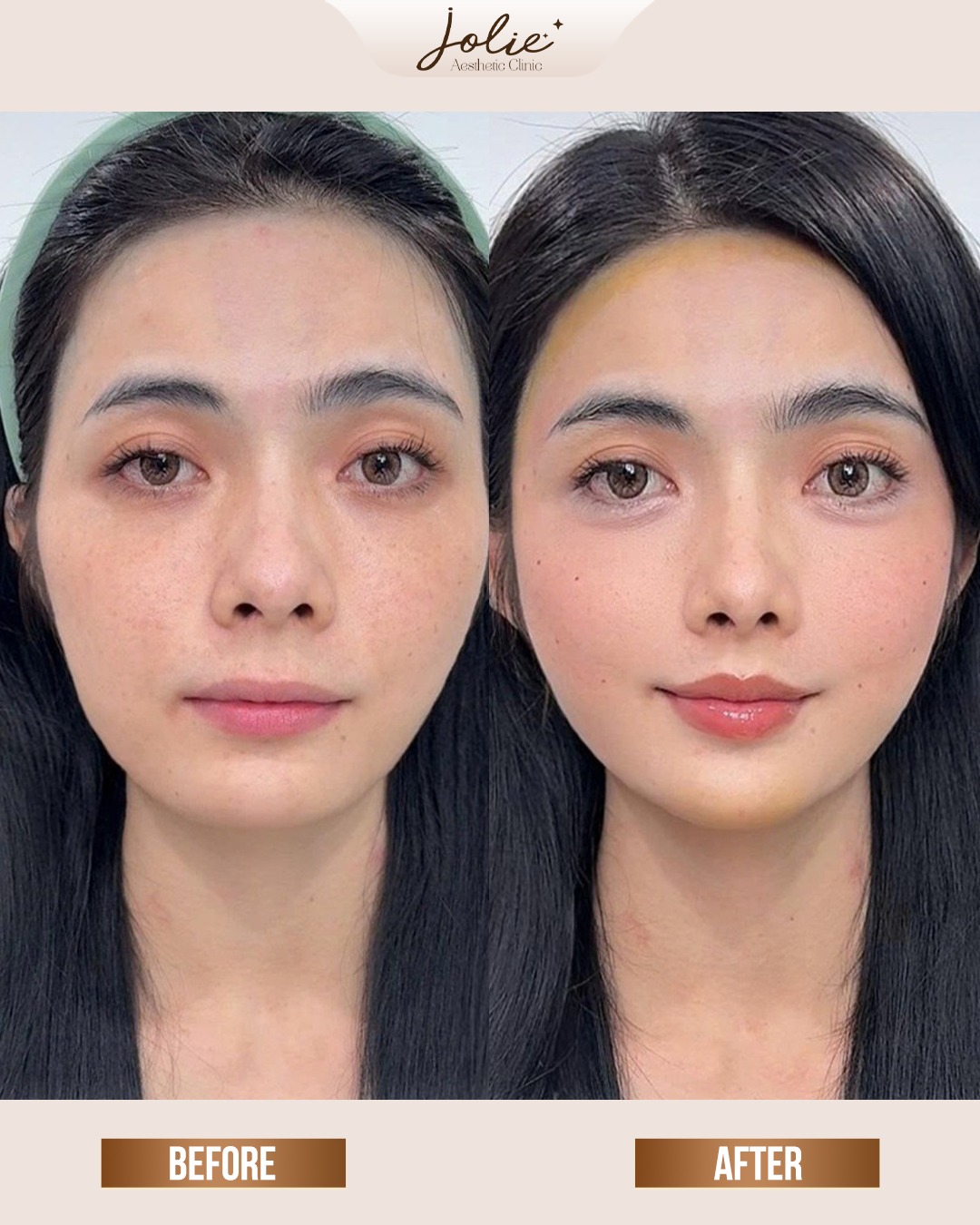 Jolie - FULL FACE BALANCING – HARMONIZING EVERY FEATURE Not about ...