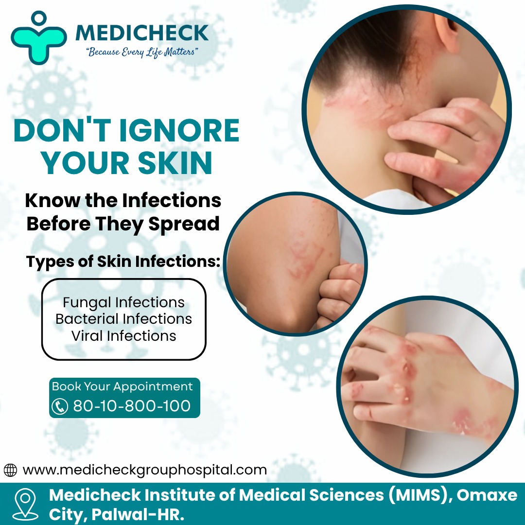 Medicheck - DON'T IGNORE YOUR SKIN! Skin problems can spread fast—know ...