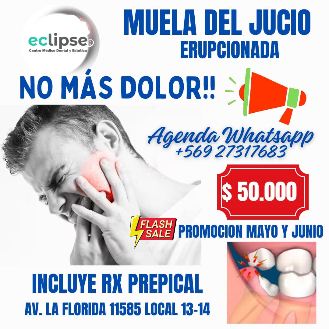 Eclipse Centro Médico Dental - Las muelas del juicio son las últimas ...