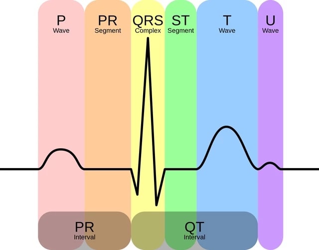EchoDx - ECG | Facebook