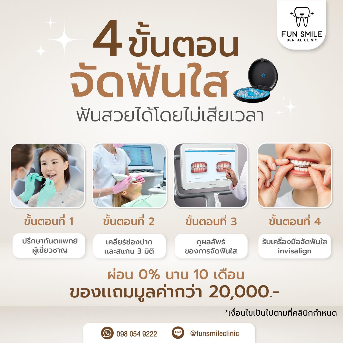 🎉🎉4... - Fun Smile ทำฟัน จัดฟัน Invisalign รากฟันเทียม
