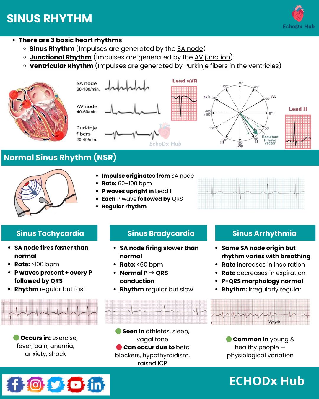 EchoDx - 🫀 Normal Sinus Rhythm (NSR) Impulse originates from SA node ...