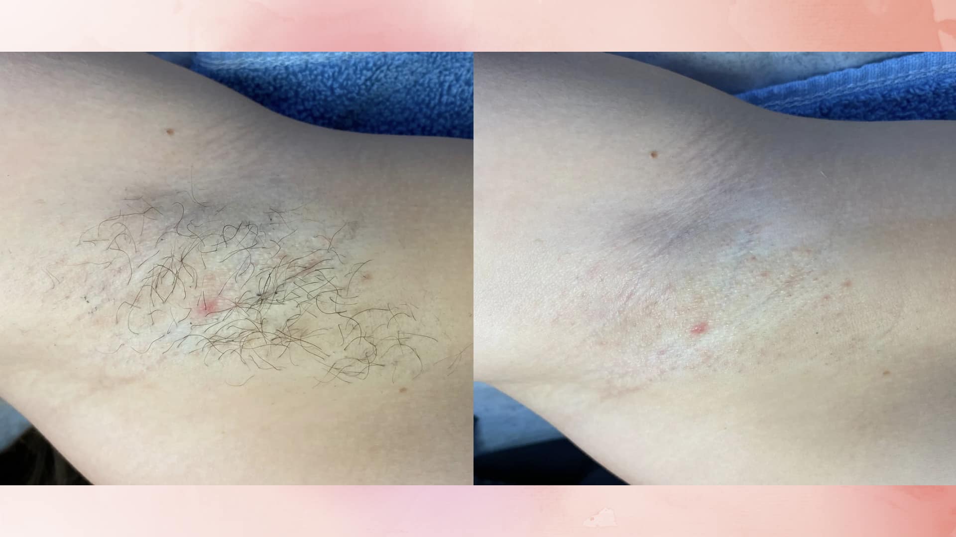 Before & after underarm wax⚡️ 🌸Get... - Waxing By Jules | Facebook