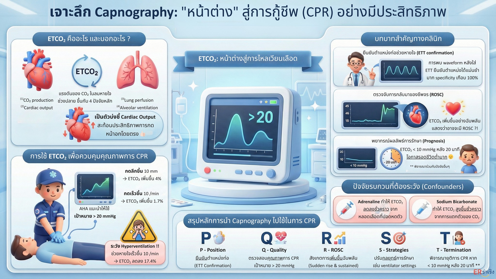 ER - 🎯 Capnography during Cardiac Arrest – ETCO₂ บอกอะไรเราได้บ้างใน ...