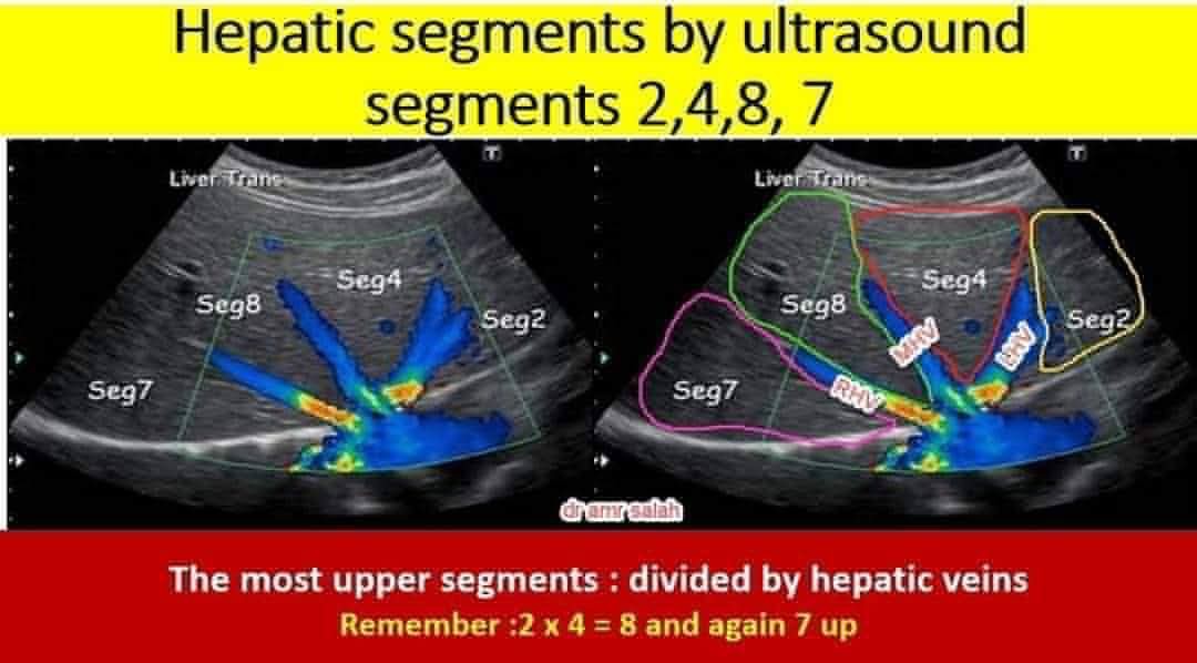 World Ultrasound Center of Education | This second image shows how to ...