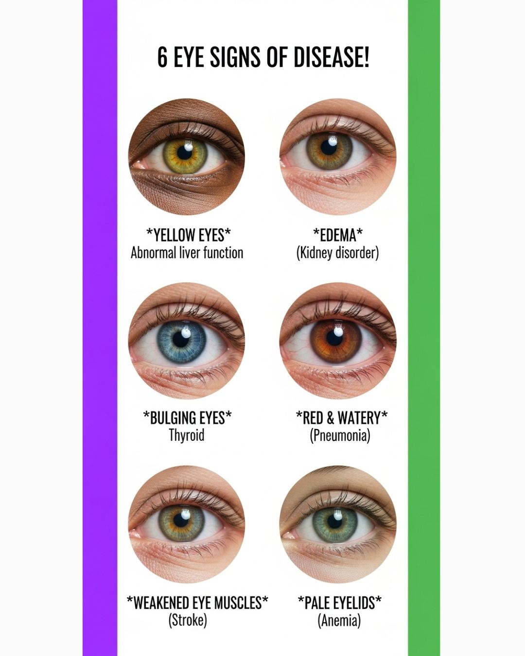 7 ways your eyes provide warning signs about your health. Via RTÉ Brainstorm