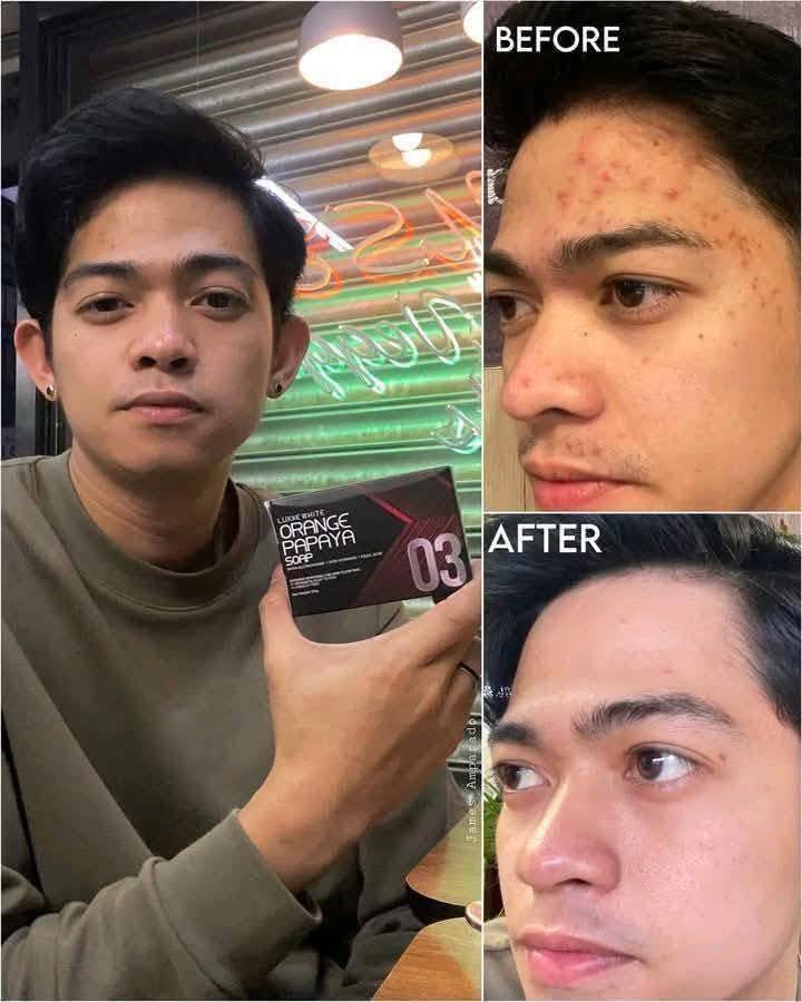 Say hello to healthier, brighter skin with Luxxe White Soaps! ✨ 🌟 01 – Restores glow for dull and tired-looking skin 🌟 02 – Gently smooths and exfoliates rough texture 🌟 03 –