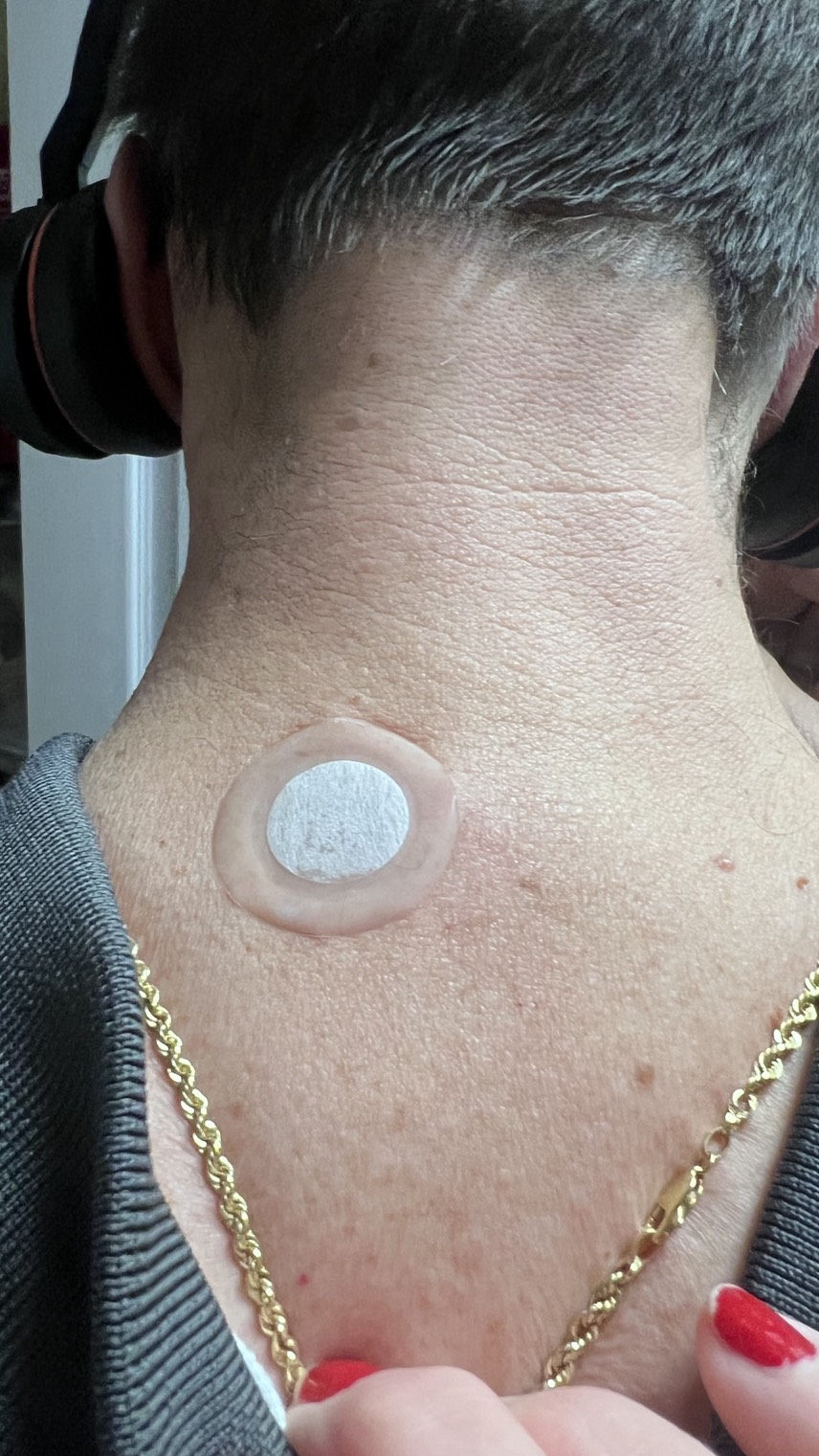 x39 patch ghk-cu study Has anyone tried the Lifewave patches? Allergy Care for Dogs & Cats