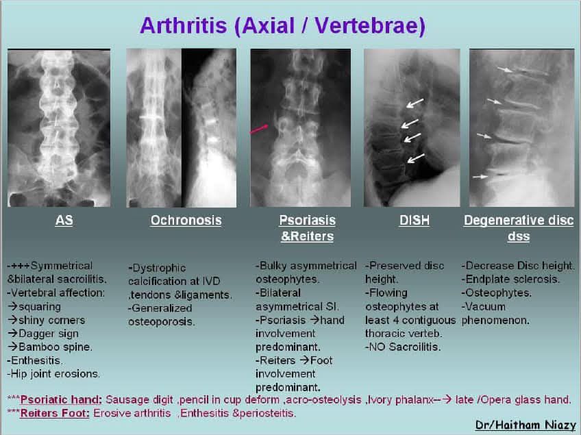 Radiology - this image is a comparative radiographic summary of ...