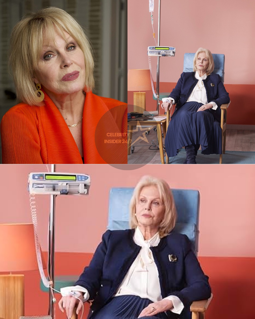joanna lumley plastic surgery Image 8