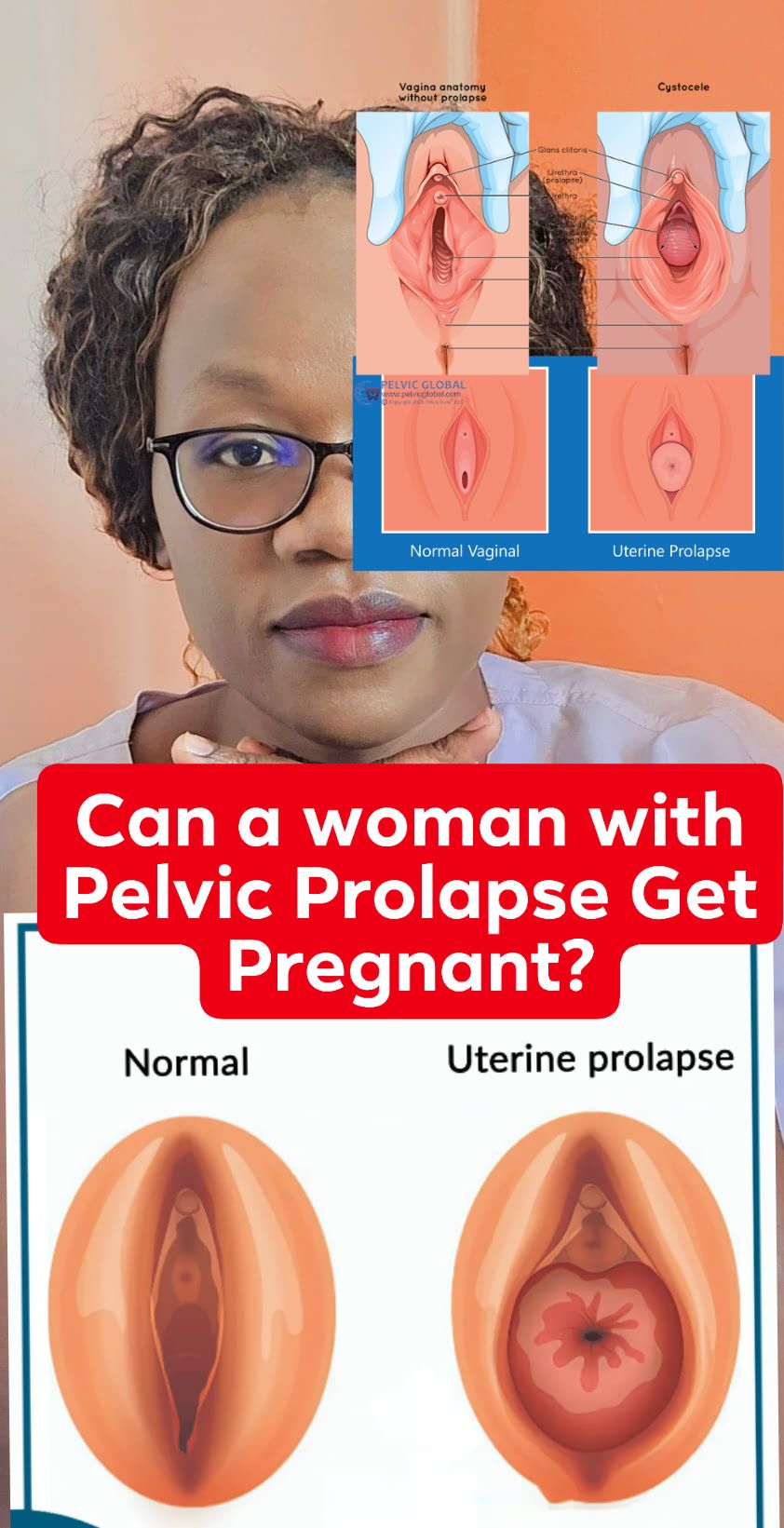 Quincy - 👩‍🍼 Can a Woman with Pelvic Prolapse Get Pregnant? Mom: Nurse ...