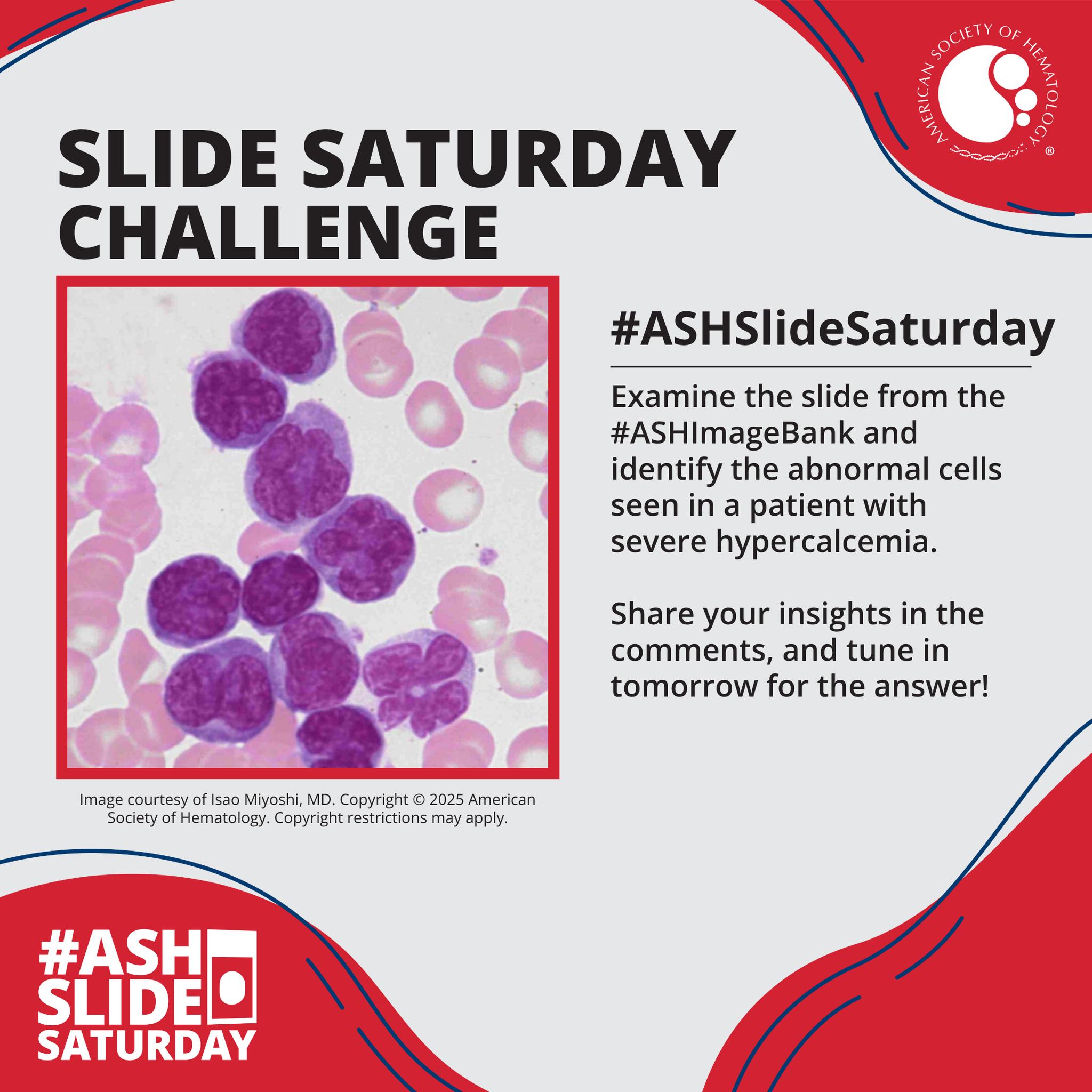 ASH Education - Take your guesses for #ASHSlideSaturday 🩸!... | Facebook