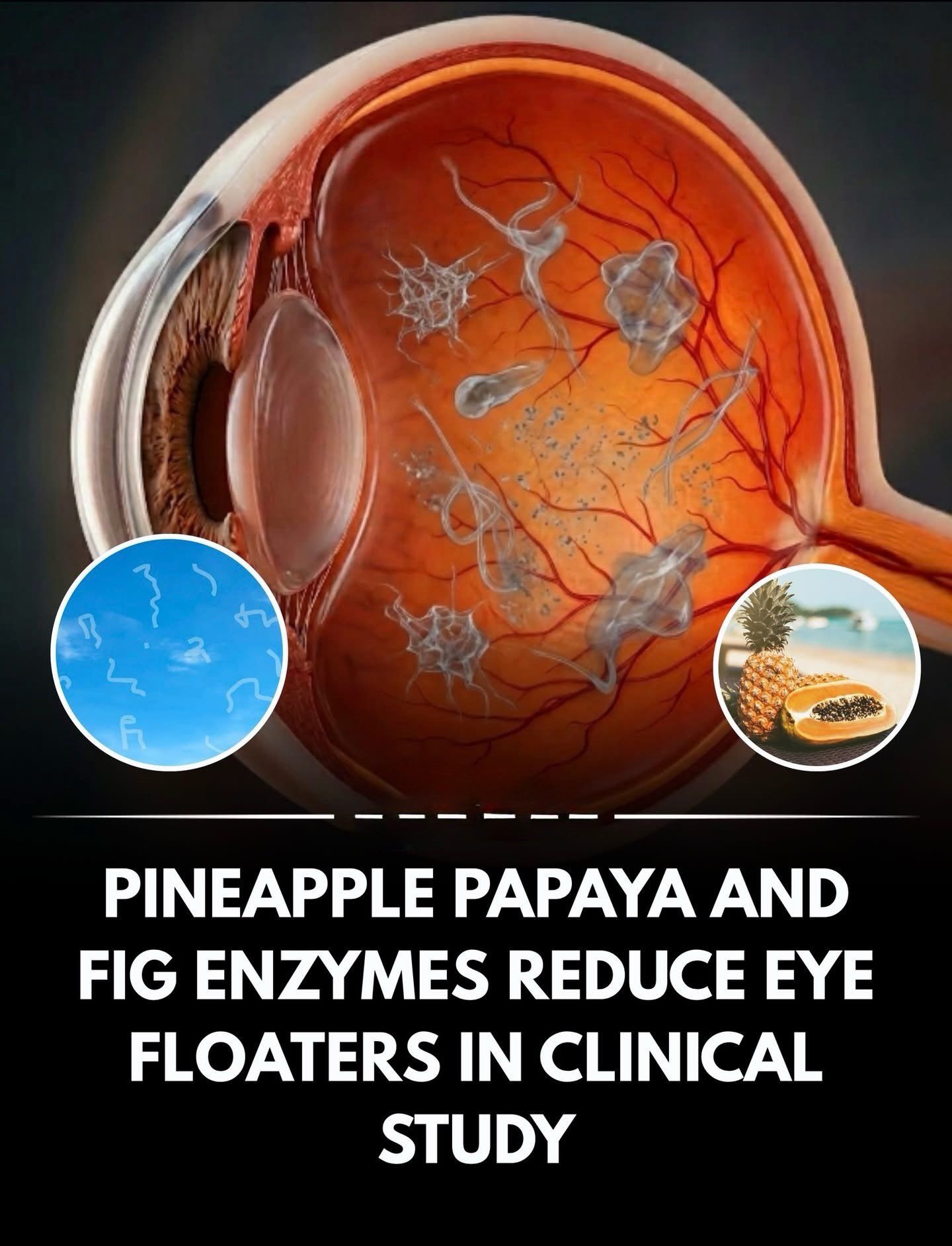 glutathione and eye floaters Floaters: Can Food Help? Here's What the Research Says Do you see little spots, threads, or cobweb-like shapes drifting across your vision? Eye are common, especially as we get older chloasma