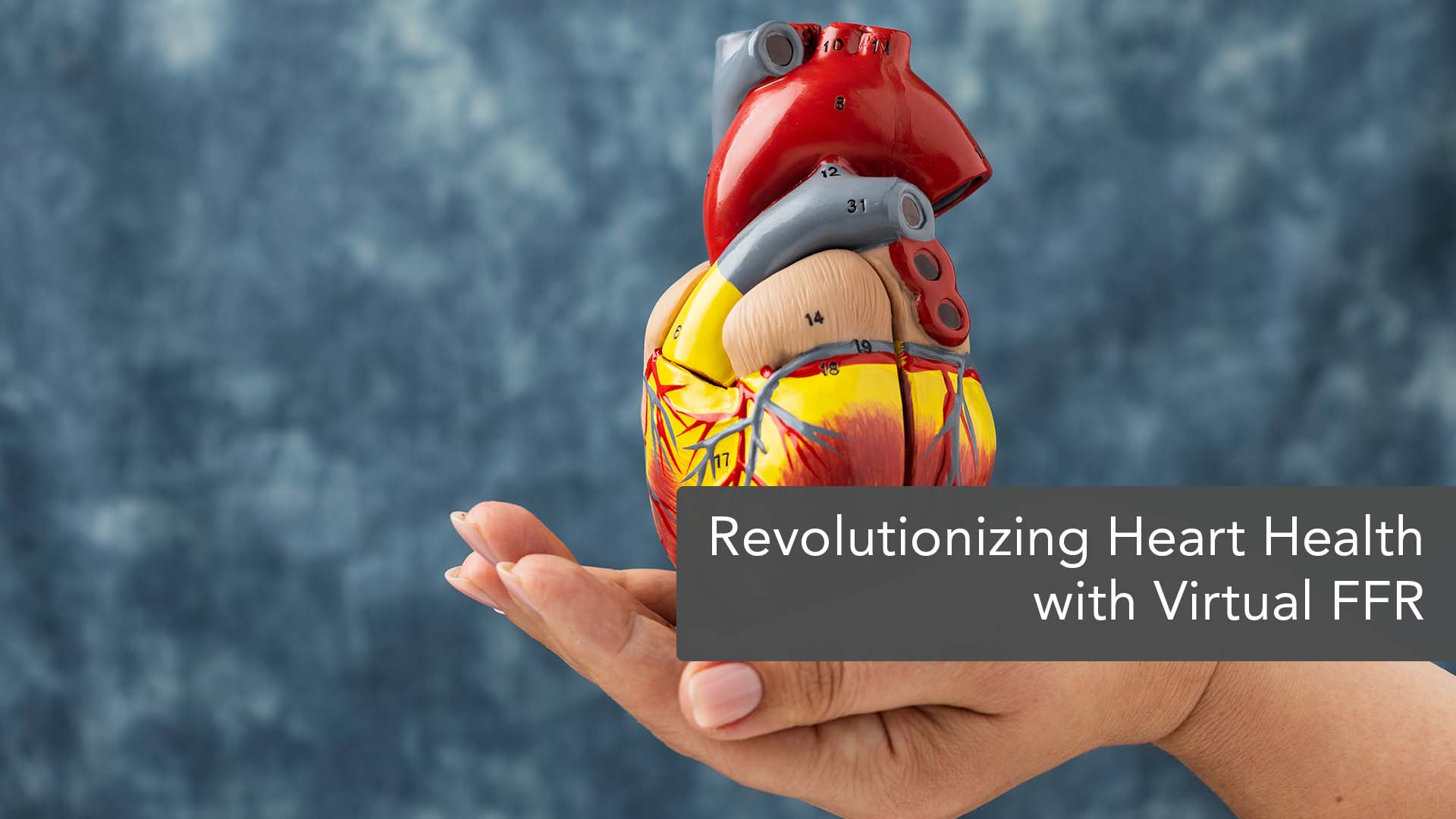 Current - Cardiology enters a new era with non-invasive Virtual FFR ...