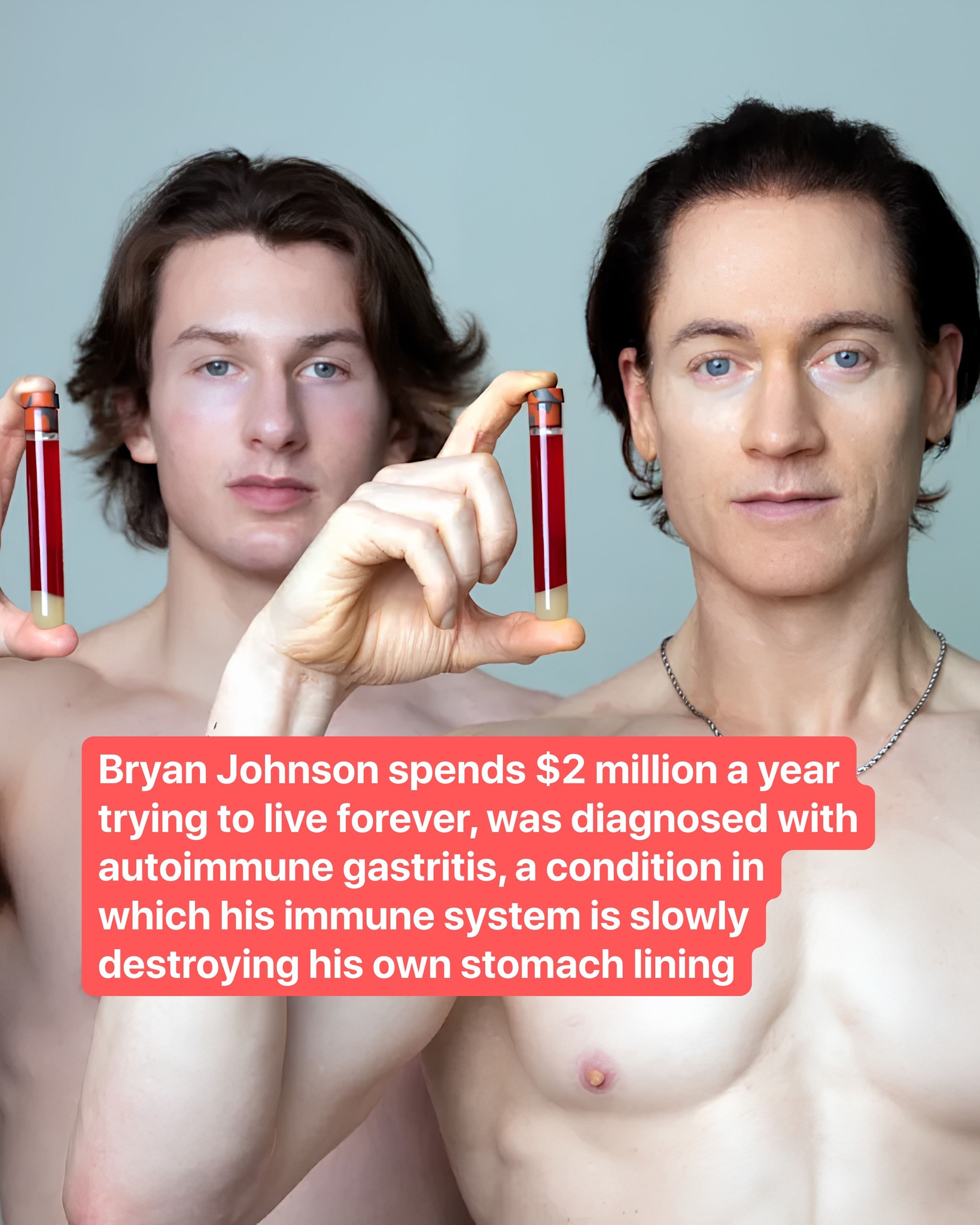Tech entrepreneur and biohacker Bryan Johnson revealed on June 30 that he has been diagnosed with Autoimmune Gastritis, saying his 'stomach is eating itself.' The diagnosis came despite no obvious symptoms, underscoring