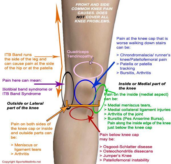 Ur.neustic - A Ur.neustic guide to knee pain | Facebook