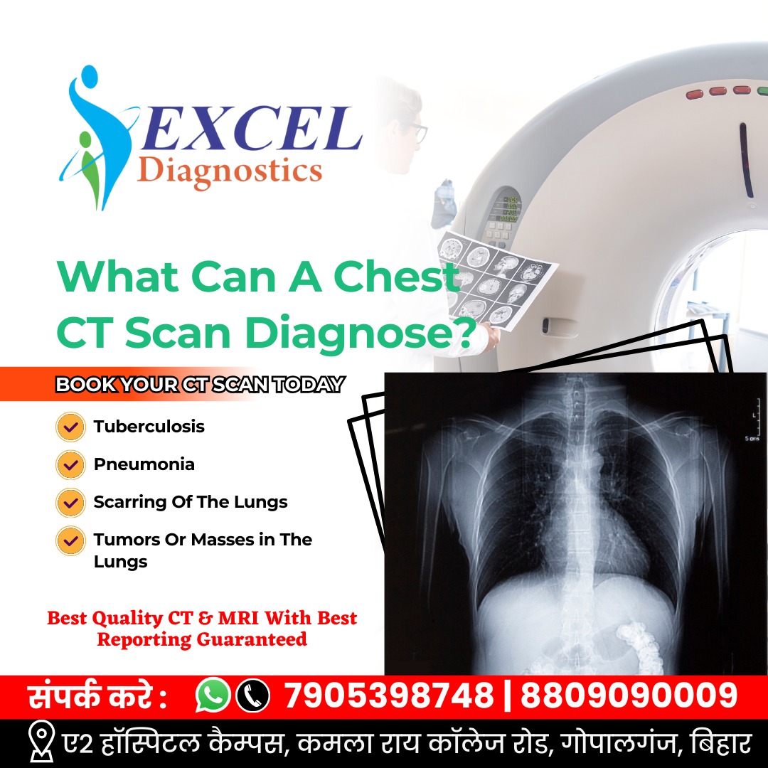 What can a Chest CT Scan diagnose? 🩻... - Excel Diagnostics | Facebook