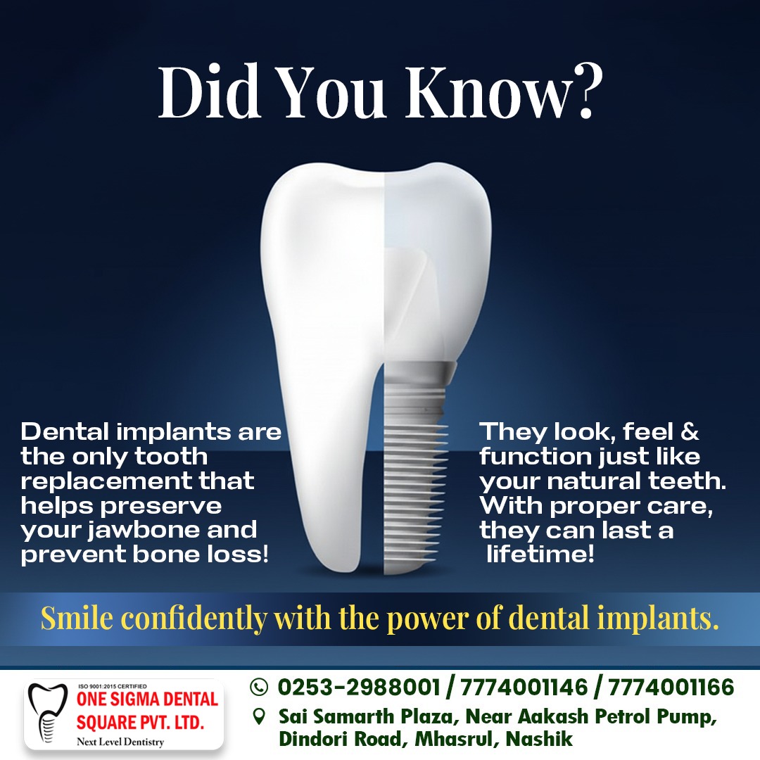 Dr.Abhijeet - Did You Know? -Dental implants are the only tooth ...