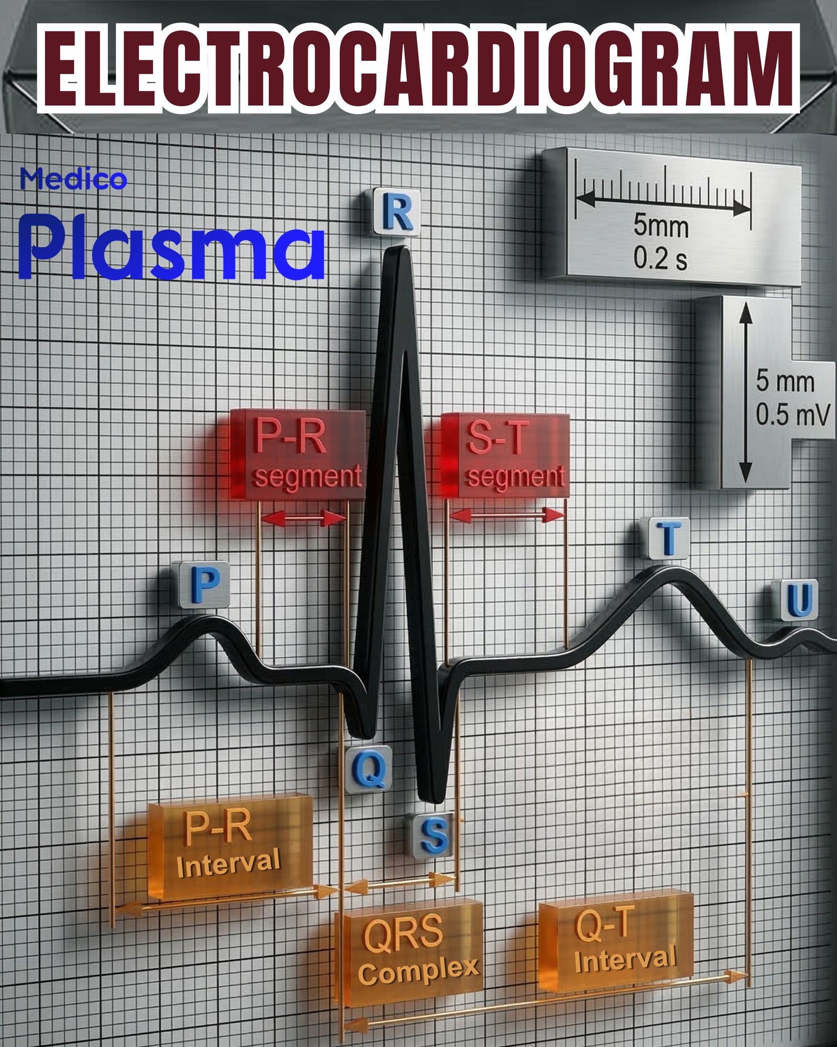 Understanding electrocardiogram readings