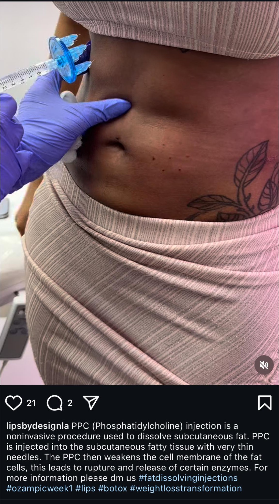 lipotropic b12 injections peachtree city ga Where to get lipo shots in Atlanta with a needle? B12 deficiency affects men