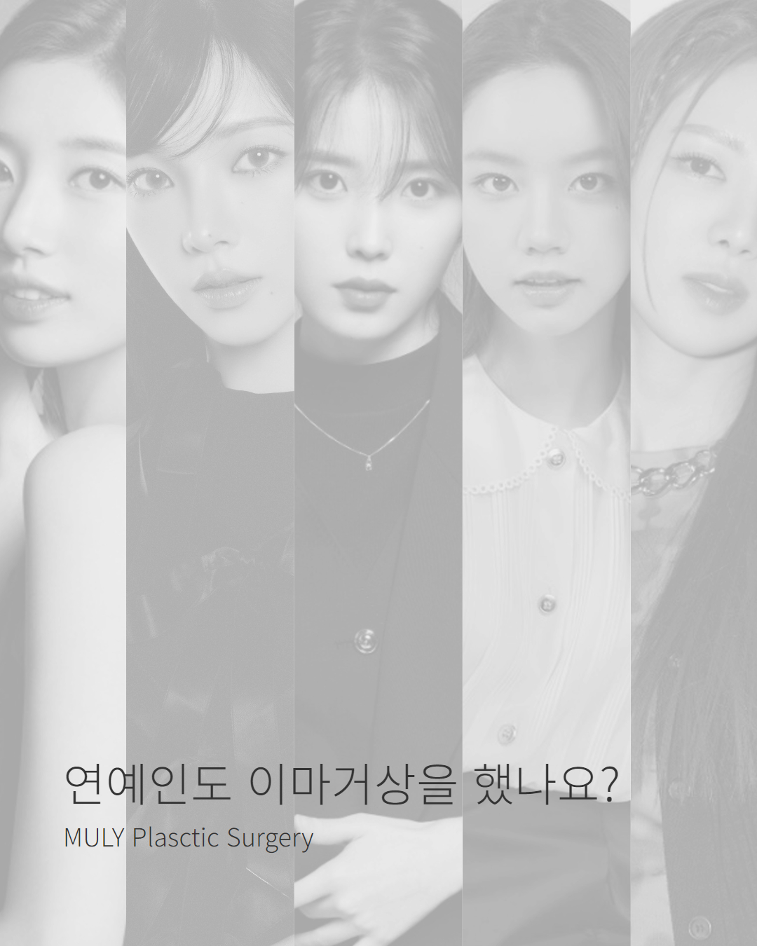 연예인도 이마거상을 했을까?🔓 ⠀ 과거와 달리 최근... - 뮬리성형외과 MULY Plastic Surgery | Facebook