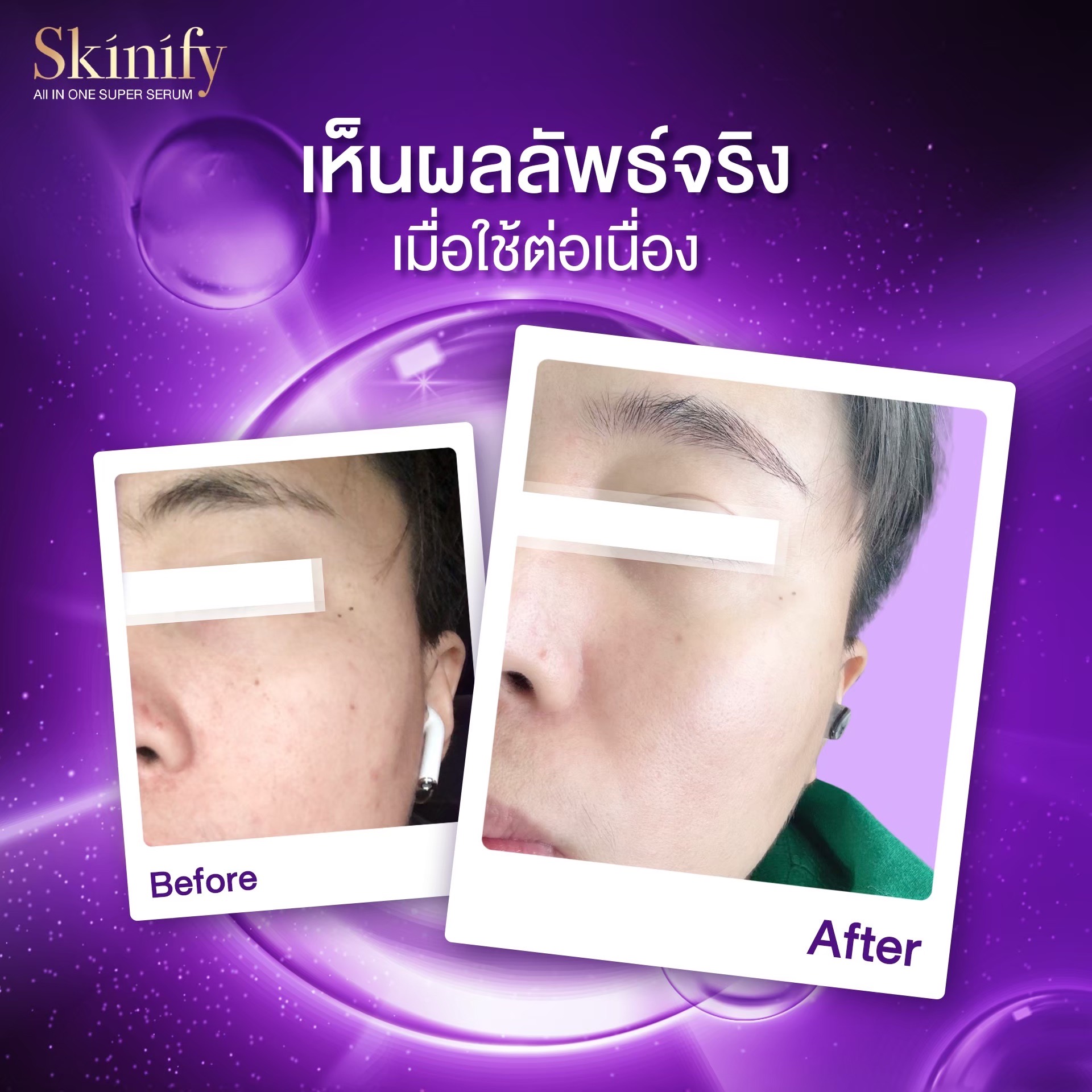 Skinify.official