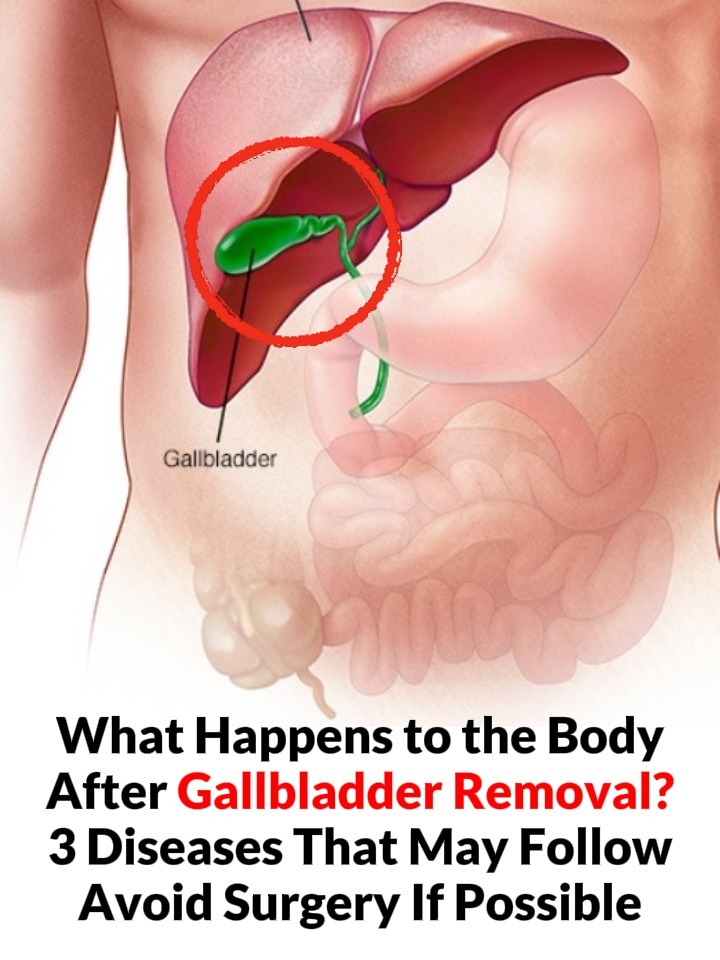 While the gallbladder is not essential for survival, its removal can have more significant consequences for bile regulation and long-term digestion than previously recognized. Modern clinical perspectives suggest that surgeons and primary