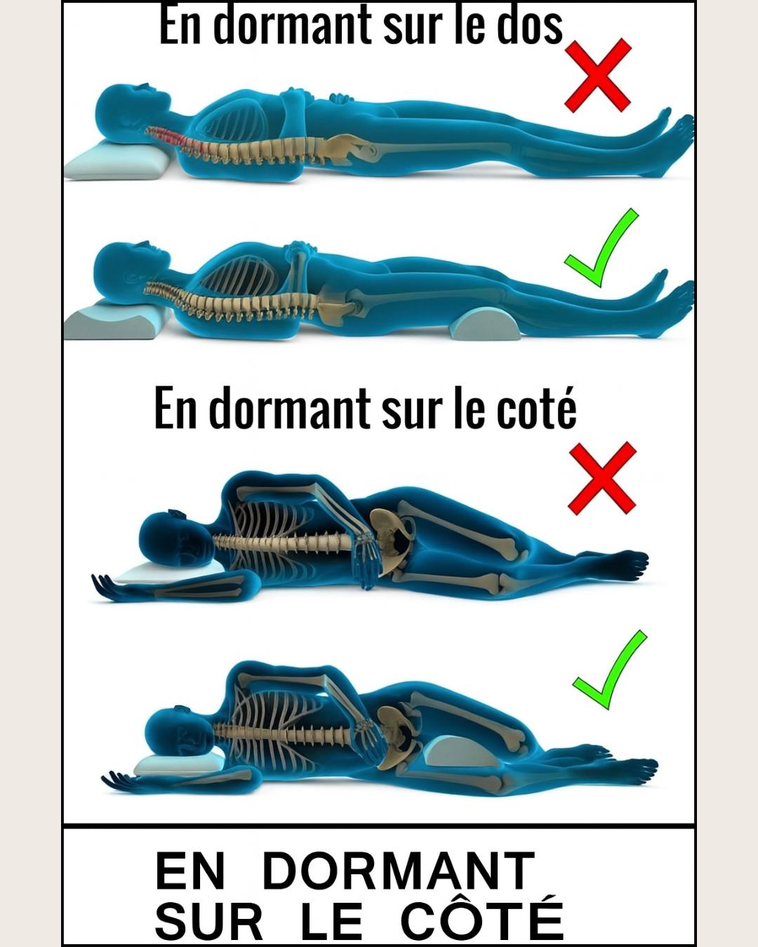 Solutions Orthopédiques pour les Douleurs aux Genoux | Cellsius – Cellsius | L'Orthopédie au service de votre bien-être