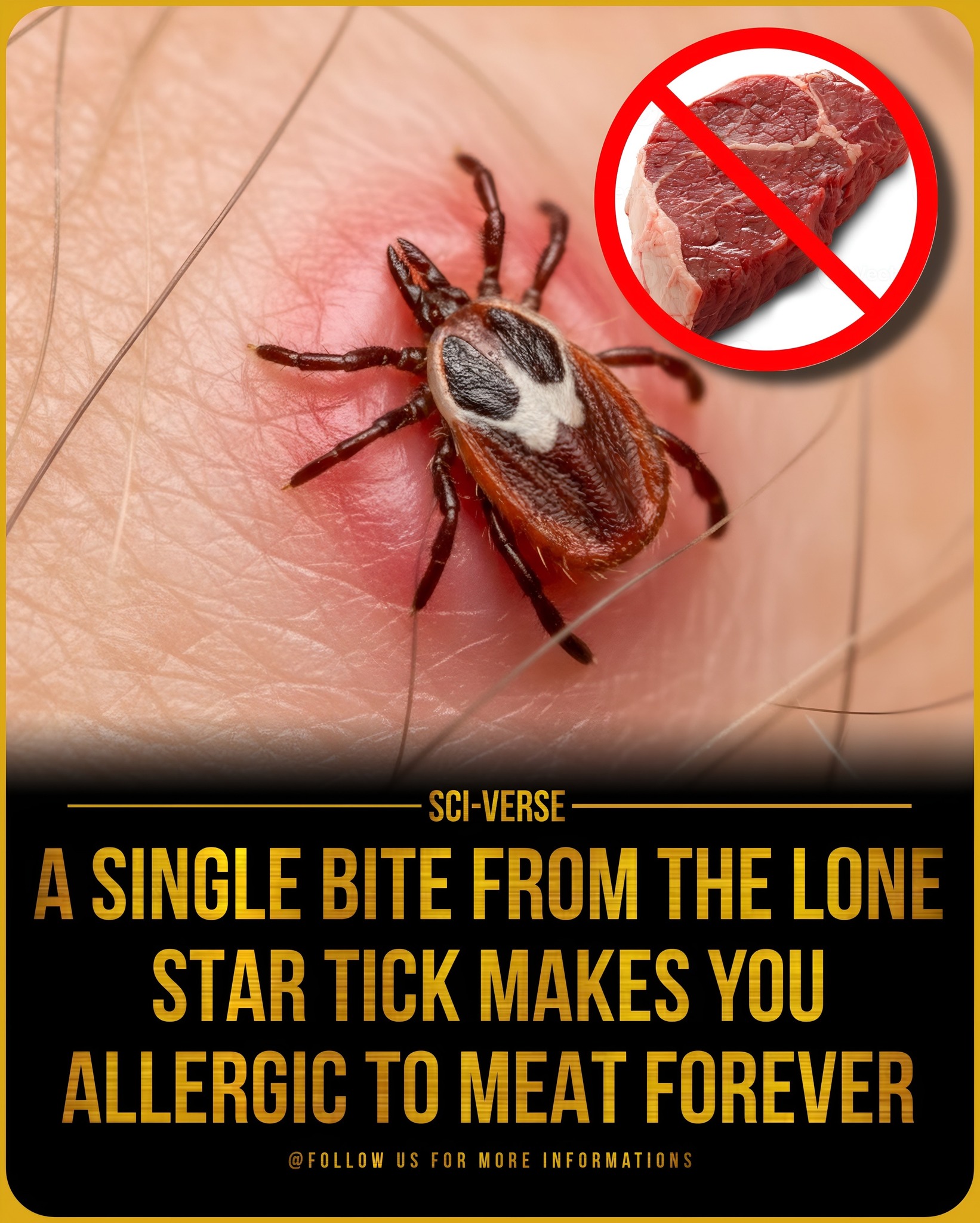 l carnitina im alergy to beef There's a tick in the South that can make you allergic STEAK. Forever. After ONE bite. 🥩 The lone star tick. Carries a sugar called alpha-gal. When she bites you, your для чего l carnitine