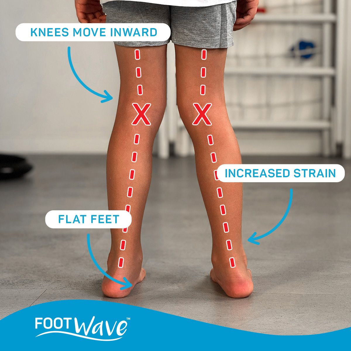 Knock... - FootWave - dynamic insoles & customizable orthotics | Facebook