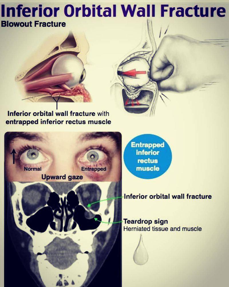 Ever - 👁️🥊 When a punch does more than leave a black eye… This is an ...