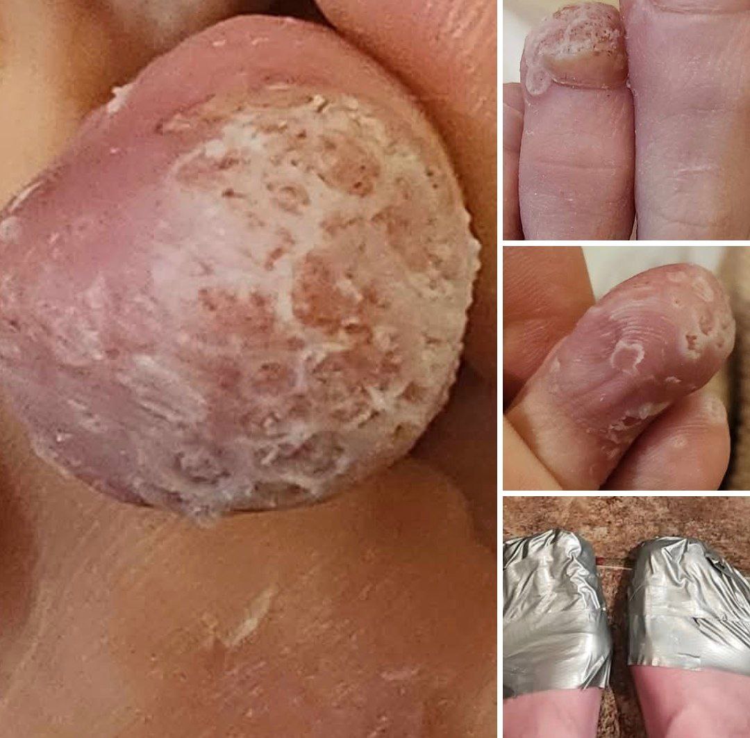 I was growing golden warts on my wife's old body #fblifestyle