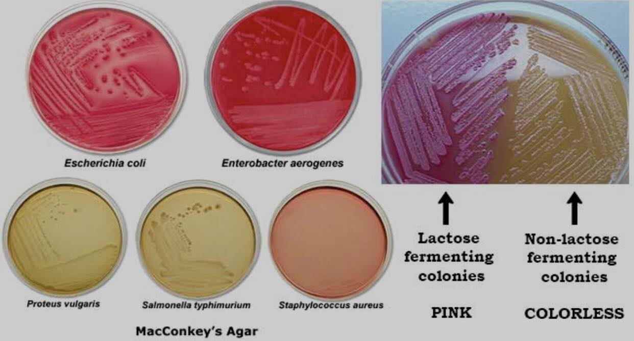 Lab - Bacteria culture🔬🔬 ️ | Facebook