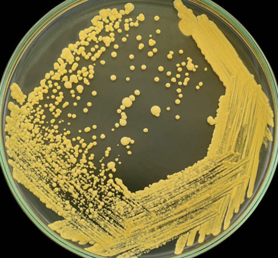 P.Willinckii Bacteria Sporeling Raised for about four years.