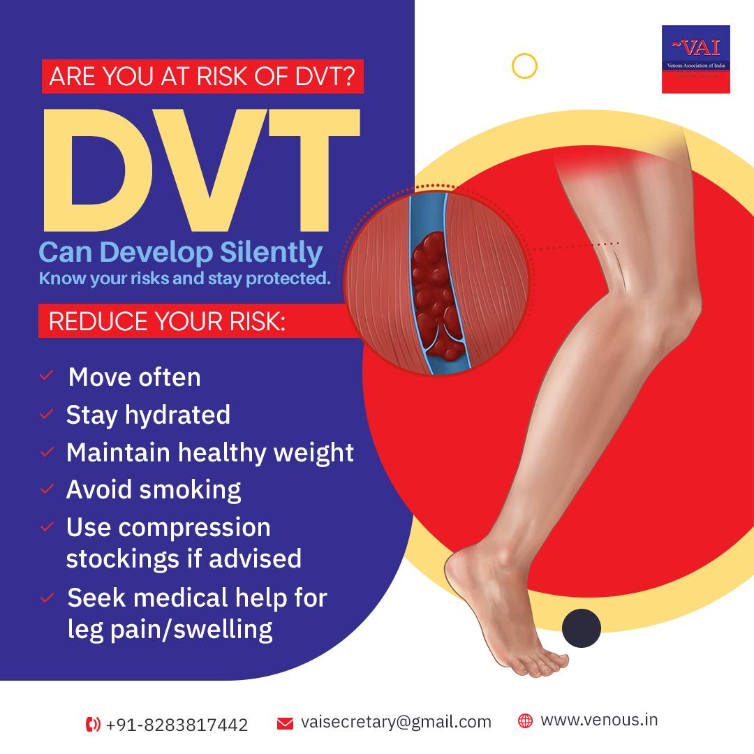Deep Vein Thrombosis (DVT)... - Venous Association of India | Facebook
