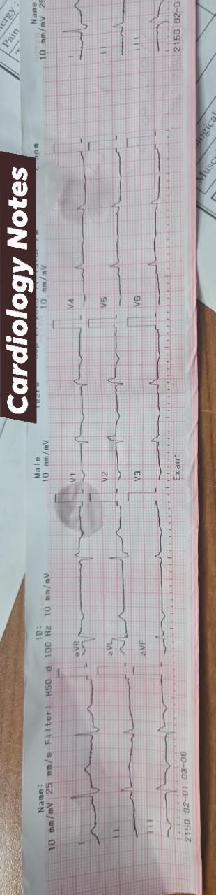 Cardiology - 41 year old male patient with history of hypertension ...