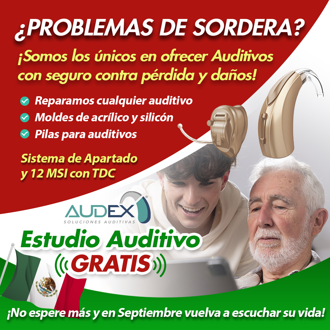Audex Chalco | Chalco